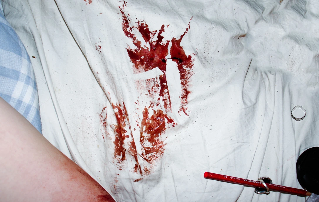 Stains